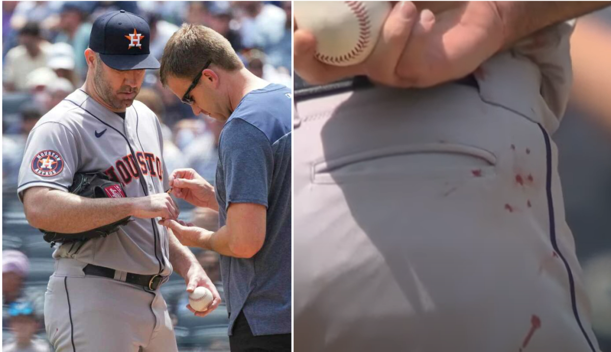 A trainer treat Justin Verlander's bl;eeding hand and blood marks on his pain on August 5, 2023, at Yankee Stadium.
